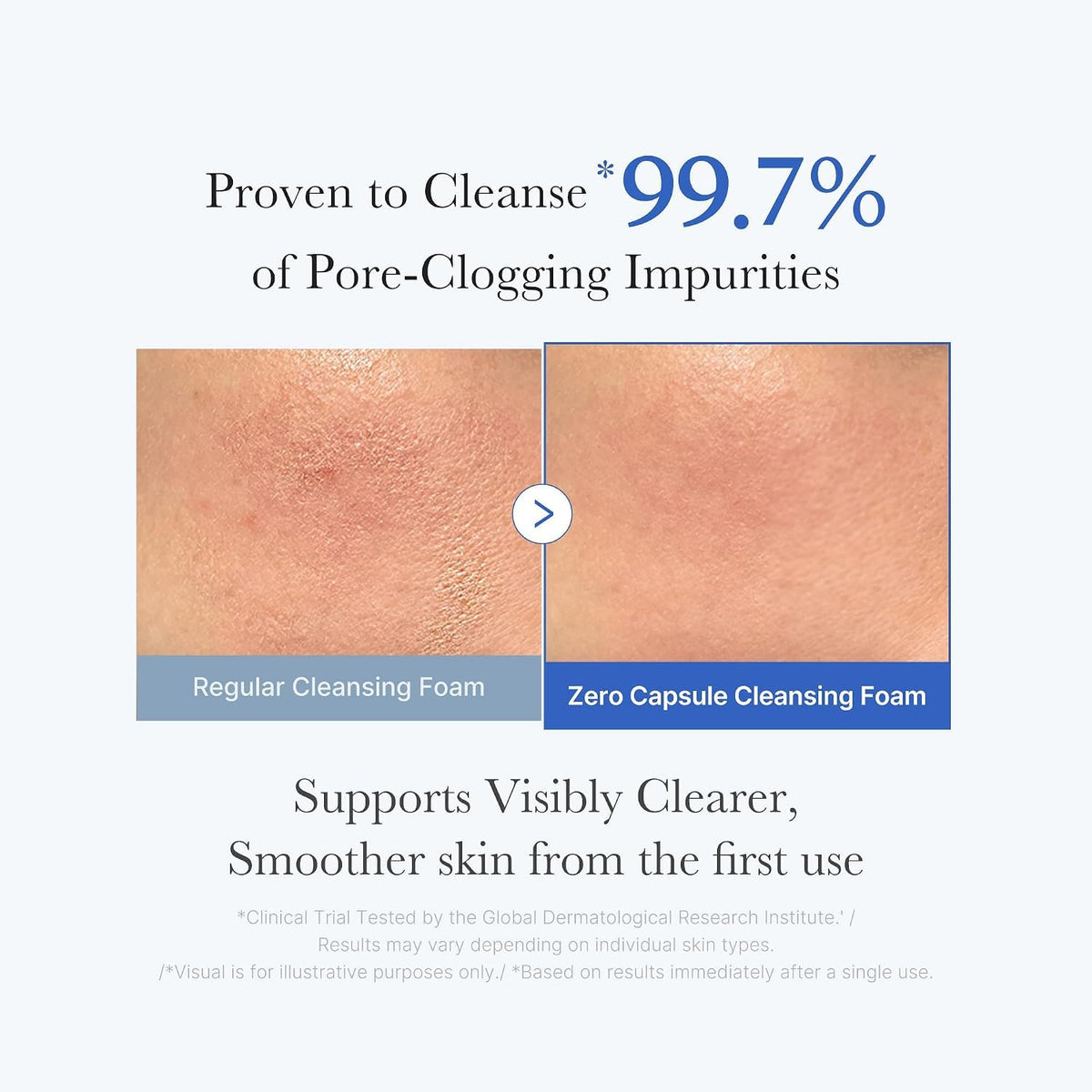 medicube Facial Cleanser Zero Foam Cleanser for Pore & Excess Oil Care