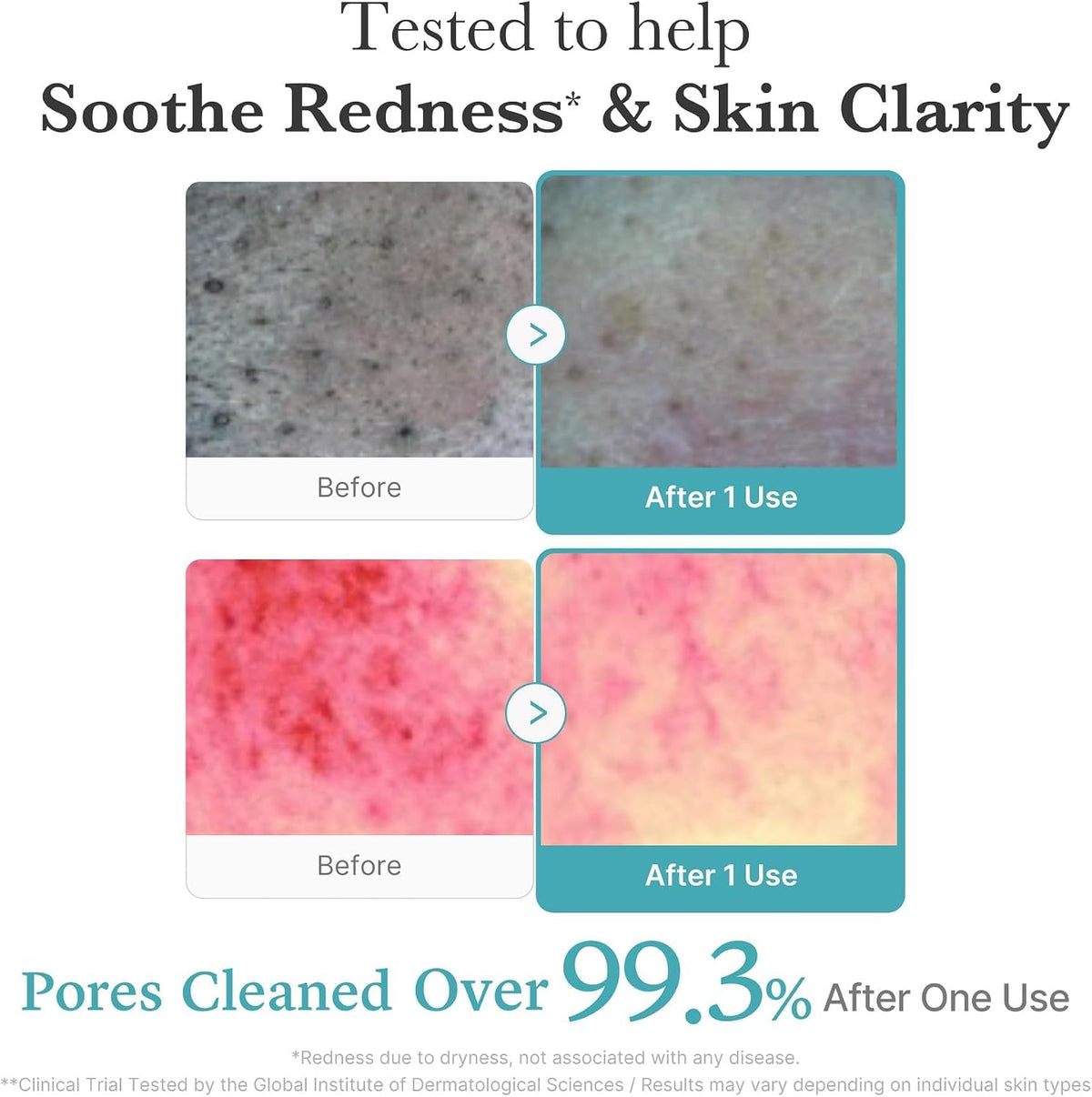 medicube Facial Cleanser Zero Foam Cleanser for Pore & Excess Oil Care