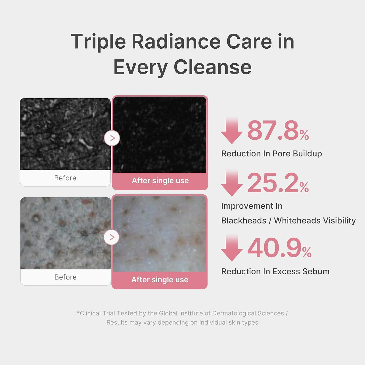 medicube Facial Cleanser Zero Foam Cleanser for Pore & Excess Oil Care