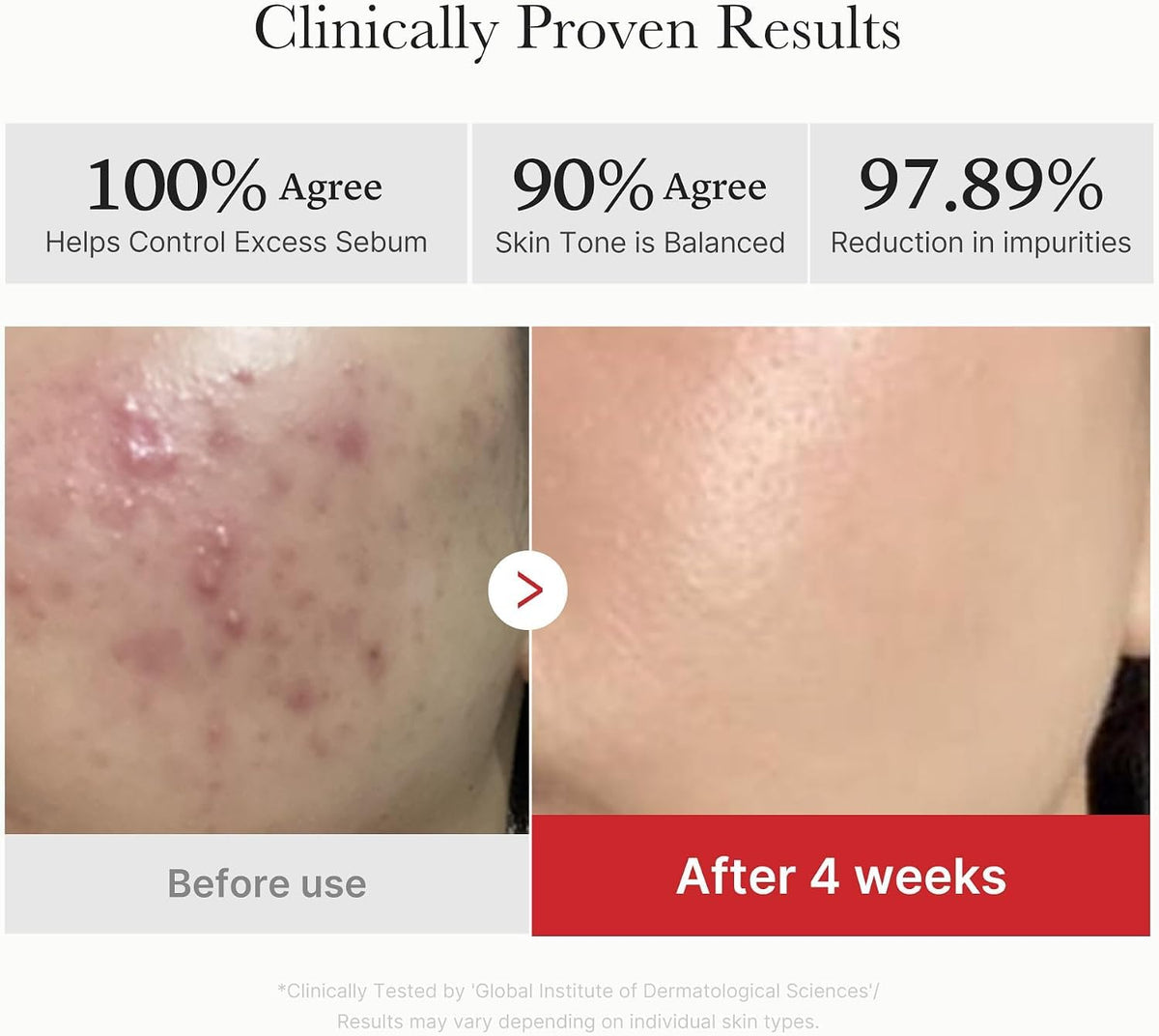 medicube Toner Pads Zero Pore Pad 2.0 for Exfoliation and Pore Care