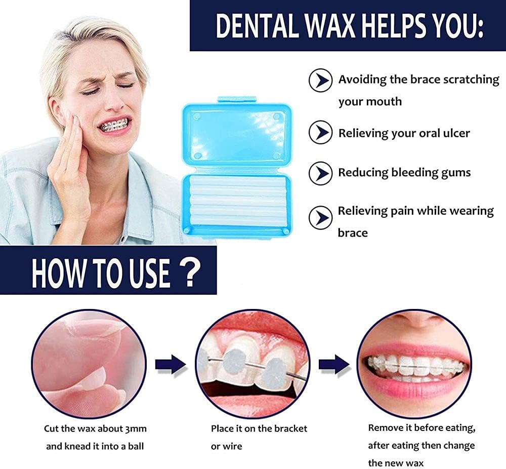 Dental Wax for Braces,Orthodontic Wax for Braces(Mint 1Box for 50Times)