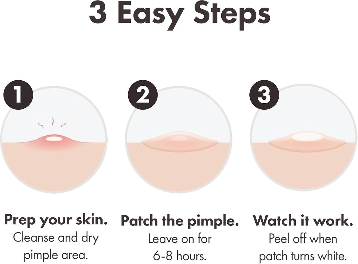 Hero Mighty Pimple Patches Original, Hydrocolloid Spot Patches, 36 Count