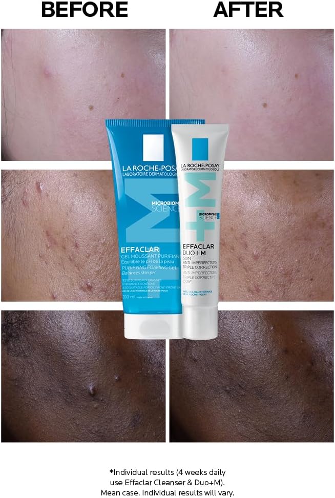 La Roche-Posay Effaclar Duo+M, Anti-Breakout Corrective Gel, 40ml