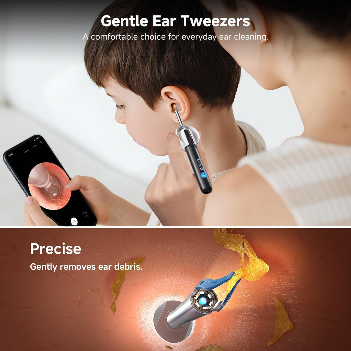 BEBIRD R1 Ultra Ear Wax Removal Camera, Ear Cleaner with Tweezers & Dropper, Visual Wax Remover Ear Pick for Family-Black