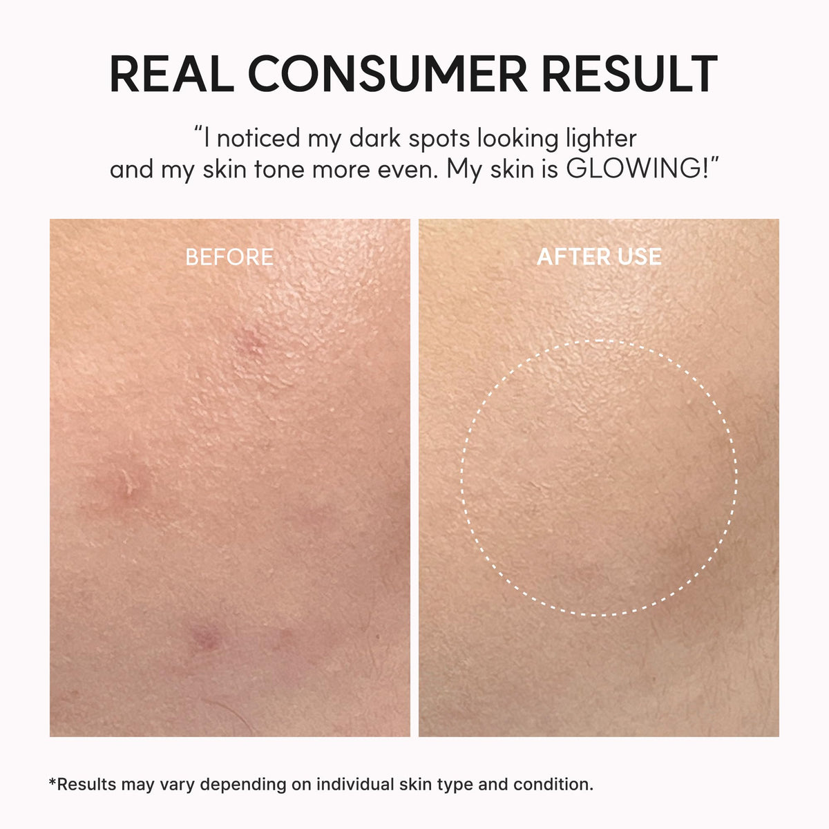 Arencia Vitamin C Booster Shot Serum with Glutathione, Niacinamide and Vitamin E for Glow Skin, 30ml