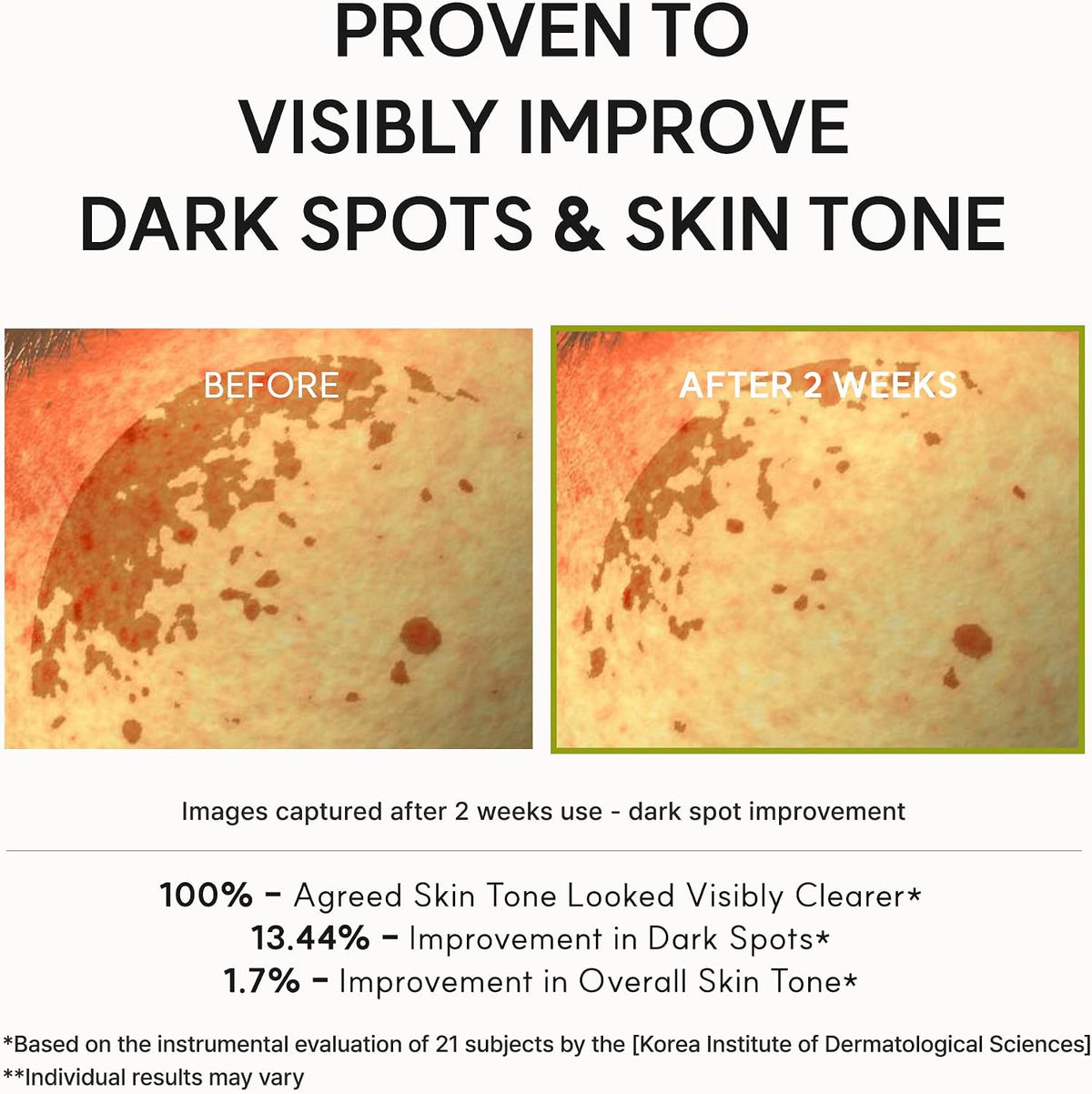 Arencia Vitamin C Booster Shot Serum with Glutathione, Niacinamide and Vitamin E for Glow Skin, 30ml