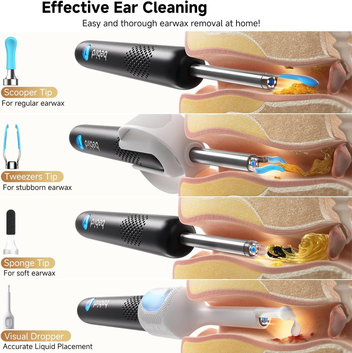 BEBIRD R1 Ultra Ear Wax Removal Camera, Ear Cleaner with Tweezers & Dropper, Visual Wax Remover Ear Pick for Family-Black