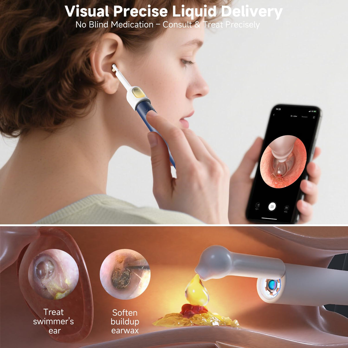 BEBIRD R1 Ultra Ear Wax Removal Camera, Ear Cleaner with Tweezers & Dropper, Visual Wax Remover Ear Pick for Family-Black