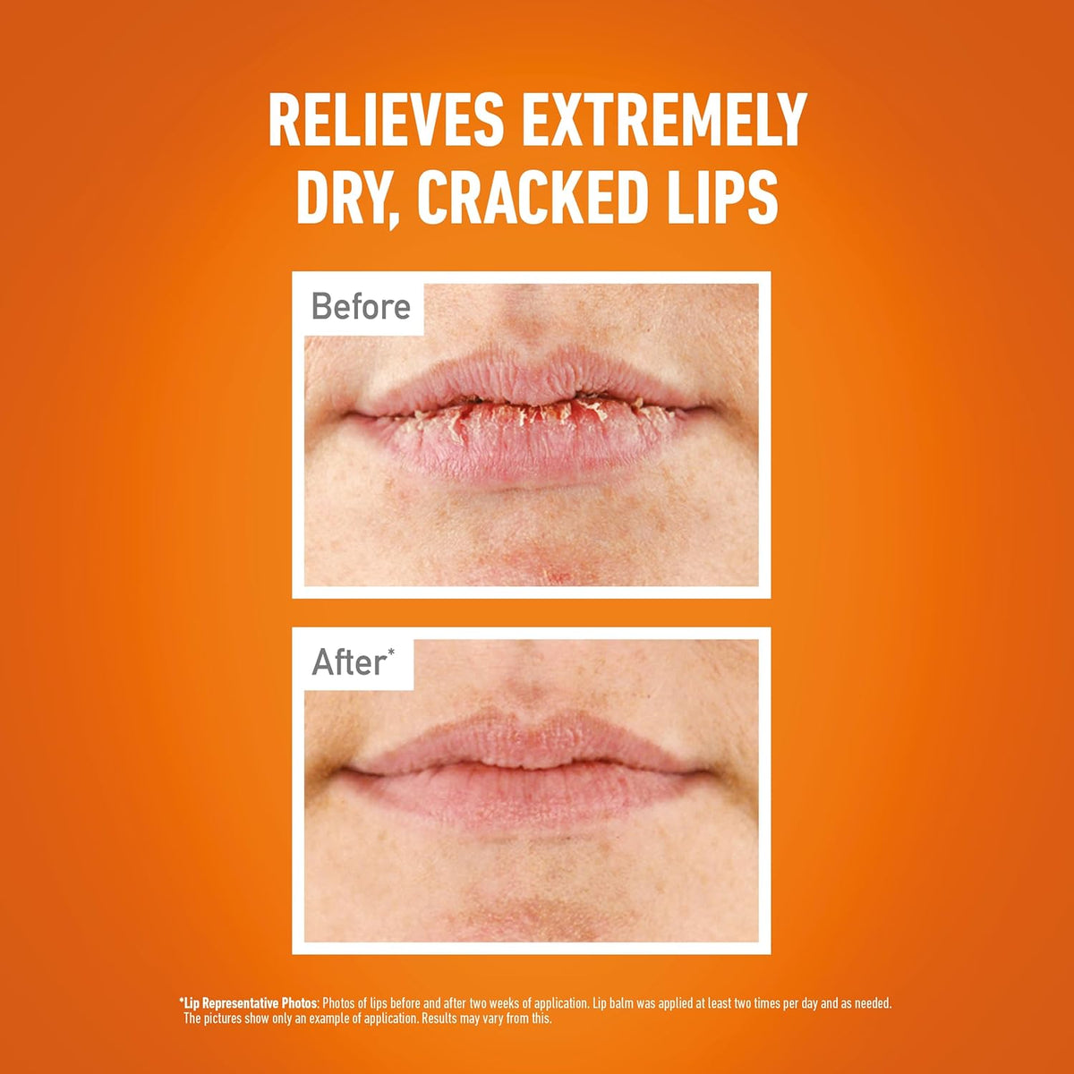 O'Keeffe's Lip Repair Unscented Lip Balm, 4.2g – For Extremely Dry, Cracked Lips | All-Day Moisture with 7 Moisturising Ingredients