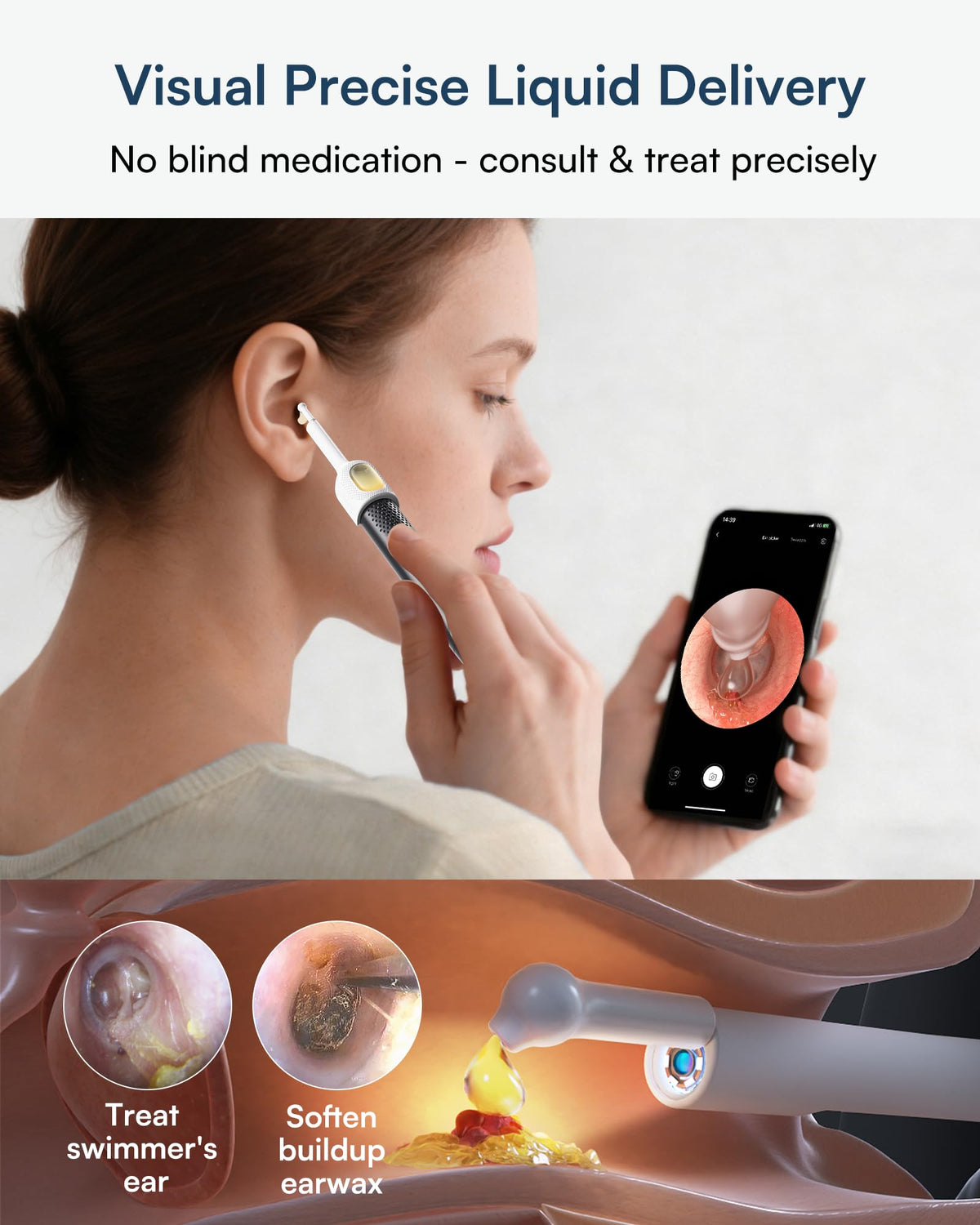 BEBIRD R1 Ultra Ear Wax Removal Camera, Ear Cleaner with Tweezers & Dropper, Visual Wax Remover Ear Pick for Family-Black