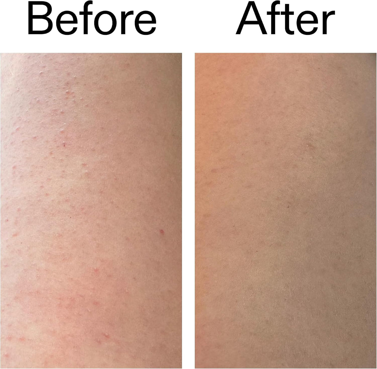 The INKEY List Glycolic Acid Exfoliating Body Wash 250ml