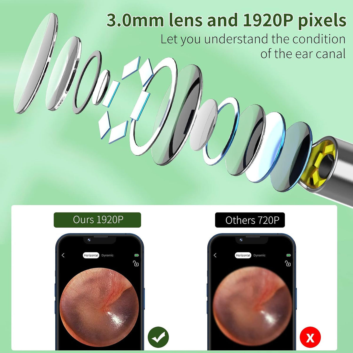Ear Wax Removal Kit, 1920P HD Ear Cleaner with Camera Ear Wax Remover Tool