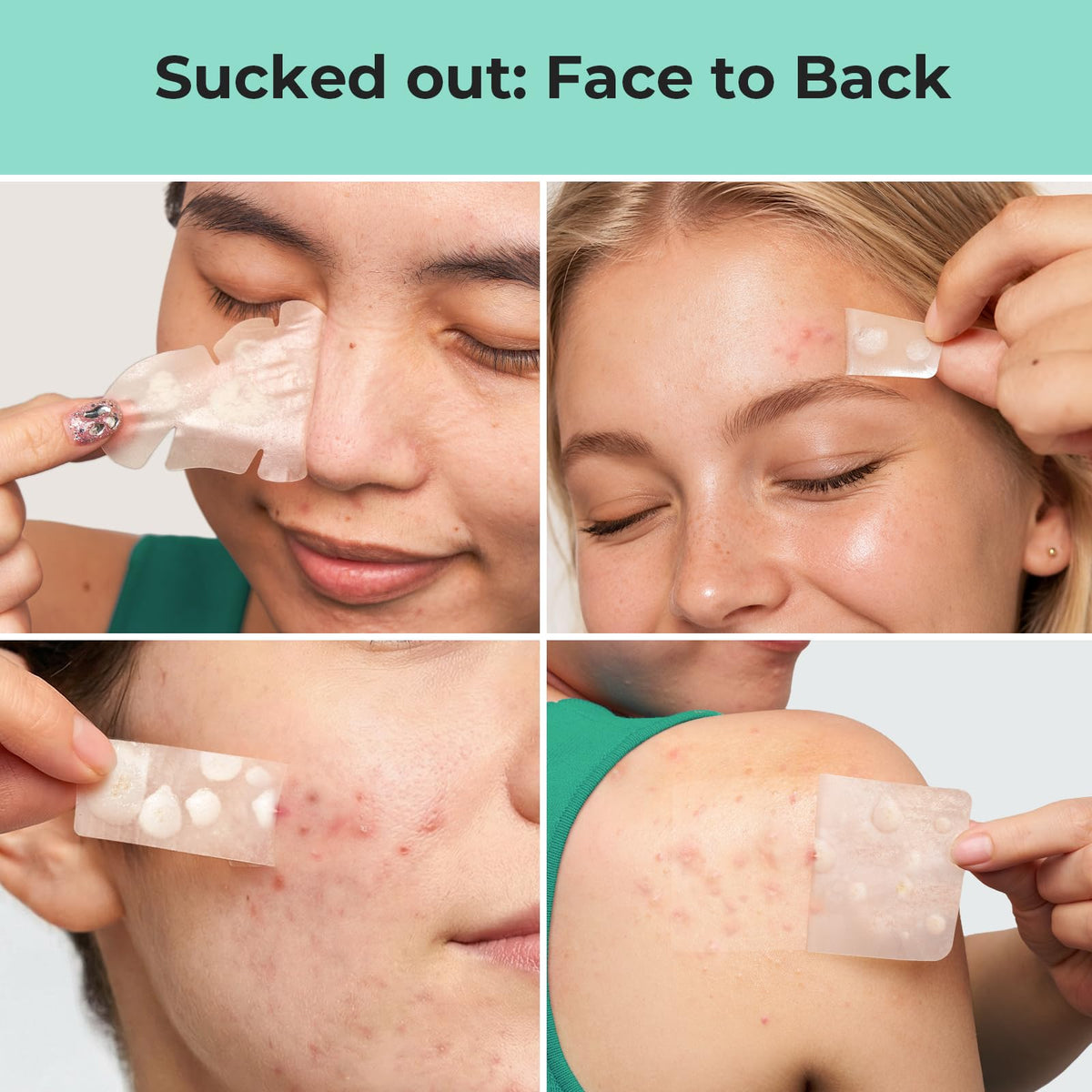 TKTK 443 Count Pimple Patches for Face, Hydrocolloid Spot Stickers, 5 Sizes