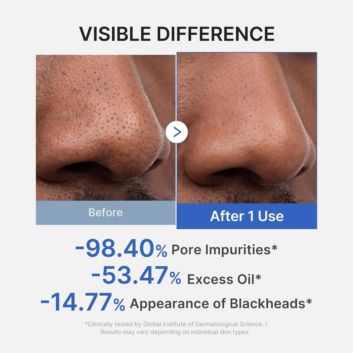 medicube Zero Pore Blackhead Mud Mask - Pore Cleansing & Gentle Exfoliating
