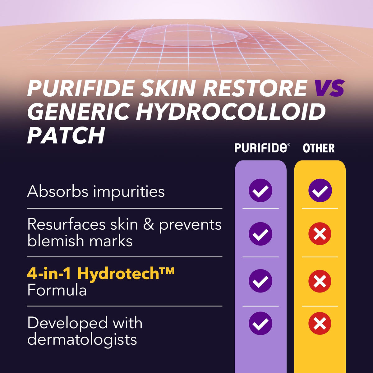 Acnecide Face Gel 5% Benzoyl Peroxide 15g