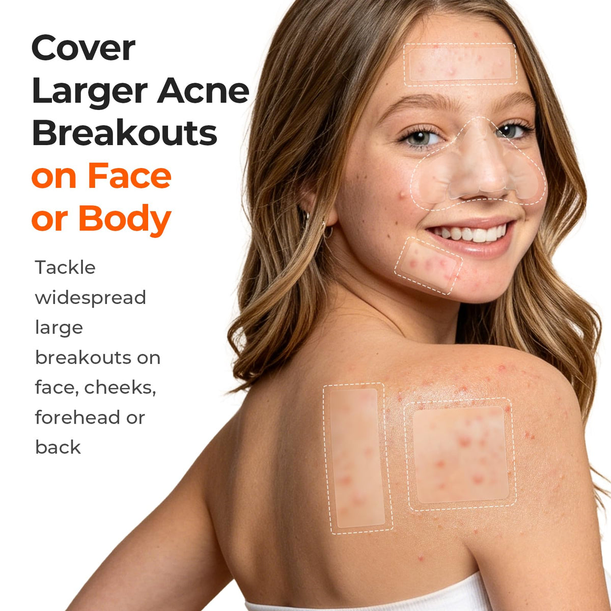 TKTK 443 Count Pimple Patches for Face, Hydrocolloid Spot Stickers, 5 Sizes