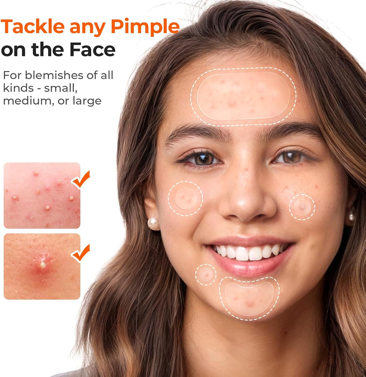 TKTK 443 Count Pimple Patches for Face, Hydrocolloid Spot Stickers, 5 Sizes