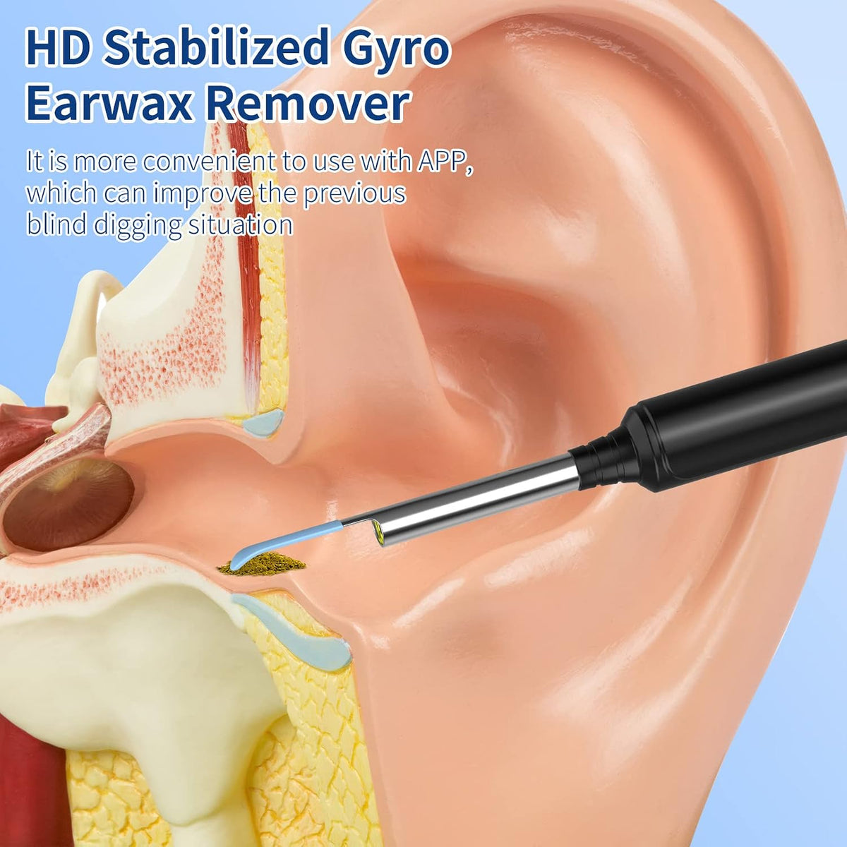 Ear Wax Removal Otoscope, WiFi 1920P Ear Cleaner Camera, 3.5mm Diameter Ear Cleaner, IP67 Waterproof Ear Camera with 6 LEDs for iPhone, iPad and Android Smartphones, Black