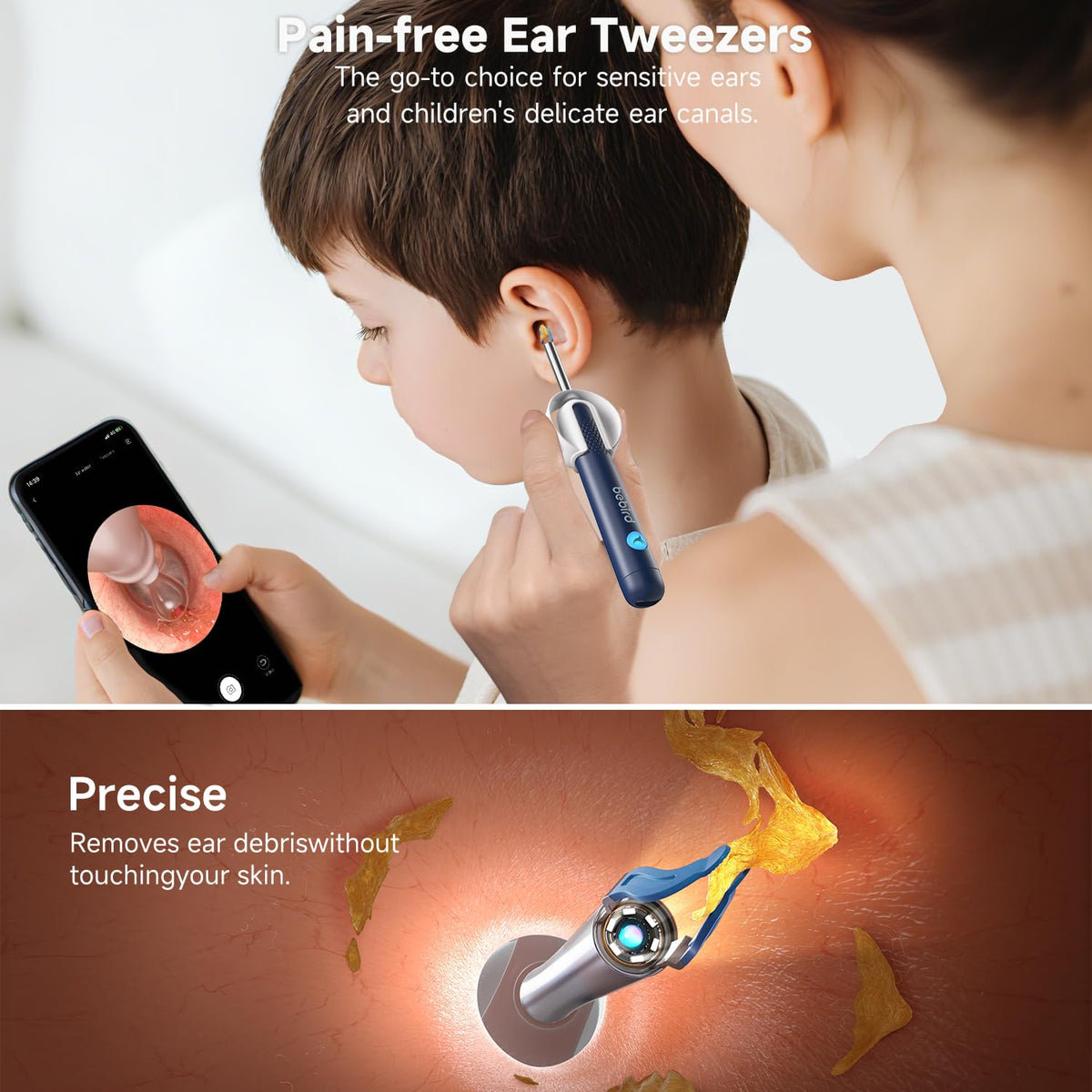 BEBIRD R1 Ultra Ear Wax Removal Camera, Ear Cleaner with Tweezers & Dropper, Visual Wax Remover Ear Pick for Family-Black