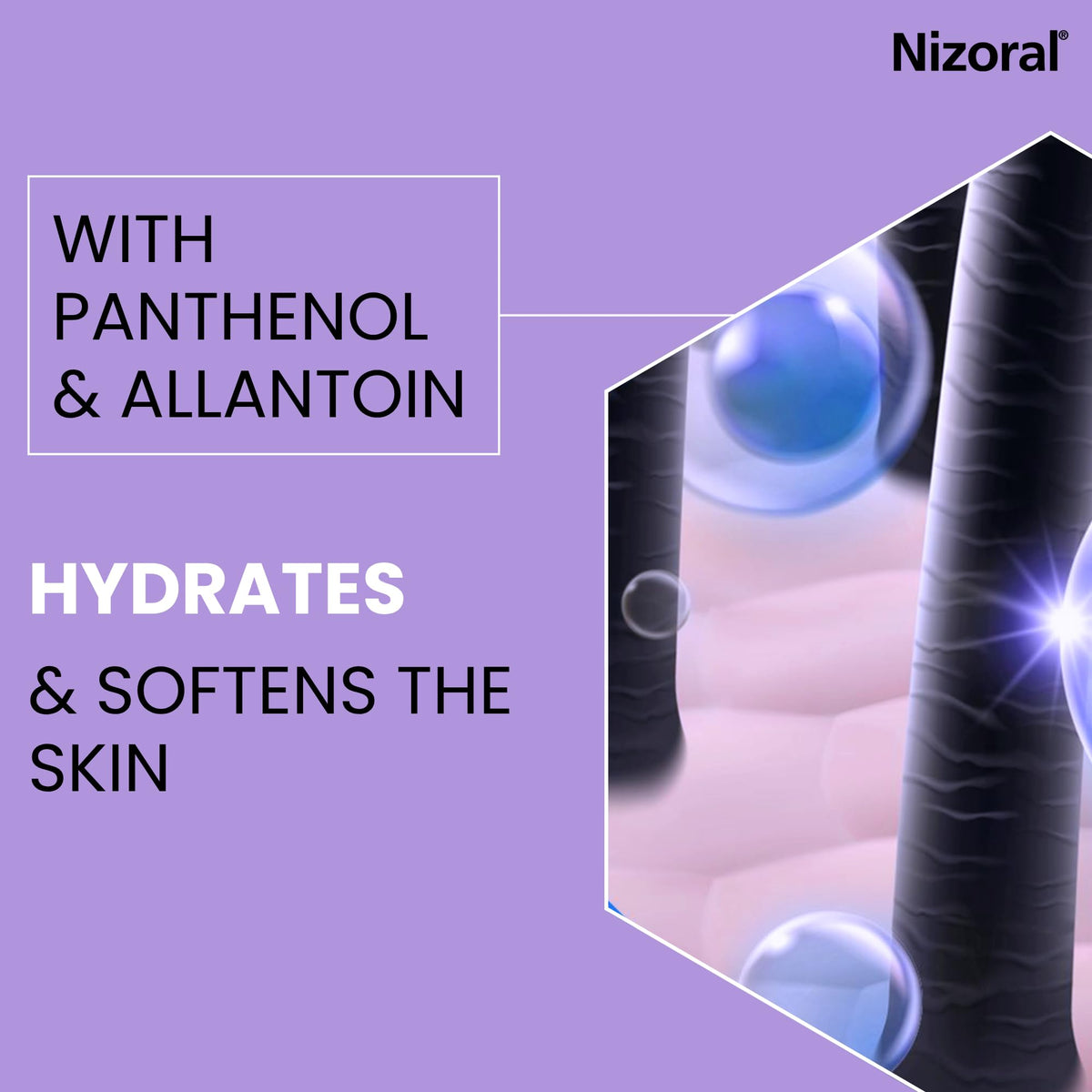 Nizoral Scalp Soothing Leave-In Treatment for Dry Itchy Scalp, 100ml
