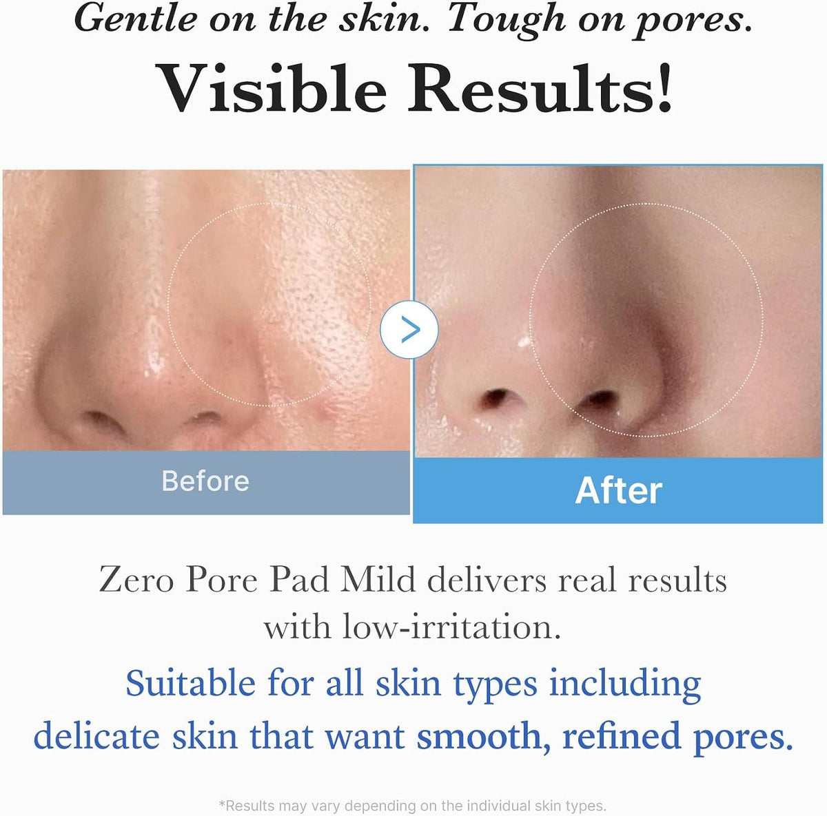 medicube Toner Pads Zero Pore Pad 2.0 for Exfoliation and Pore Care