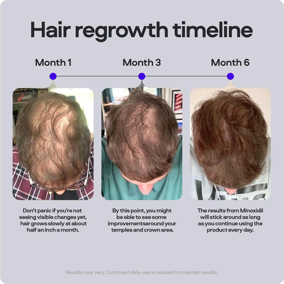 Sons Minoxidil 5% Spray (3x60ml), Hair Regrowth Treatment for Men