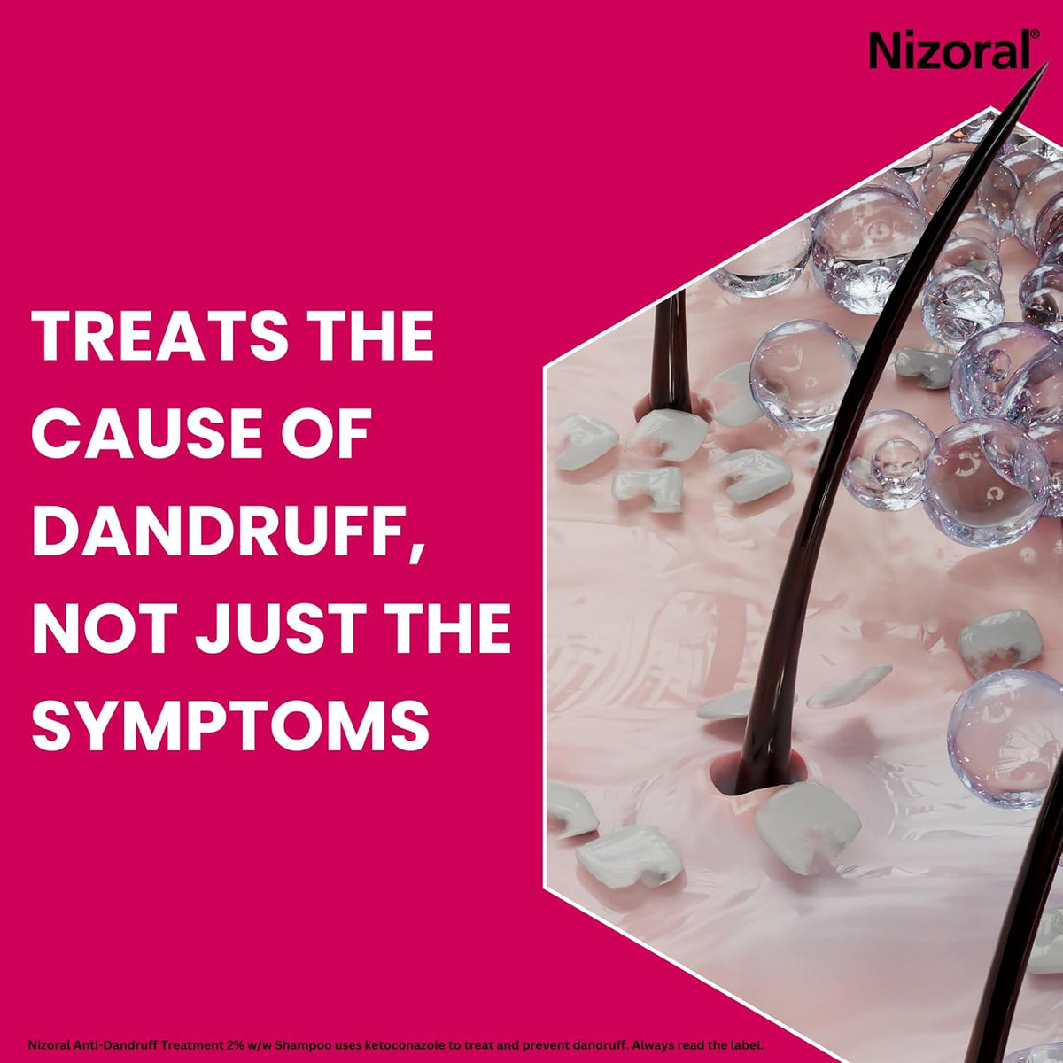 Nizoral Anti-Dandruff Treatment Shampoo with Ketoconazole, 1 x 60ml