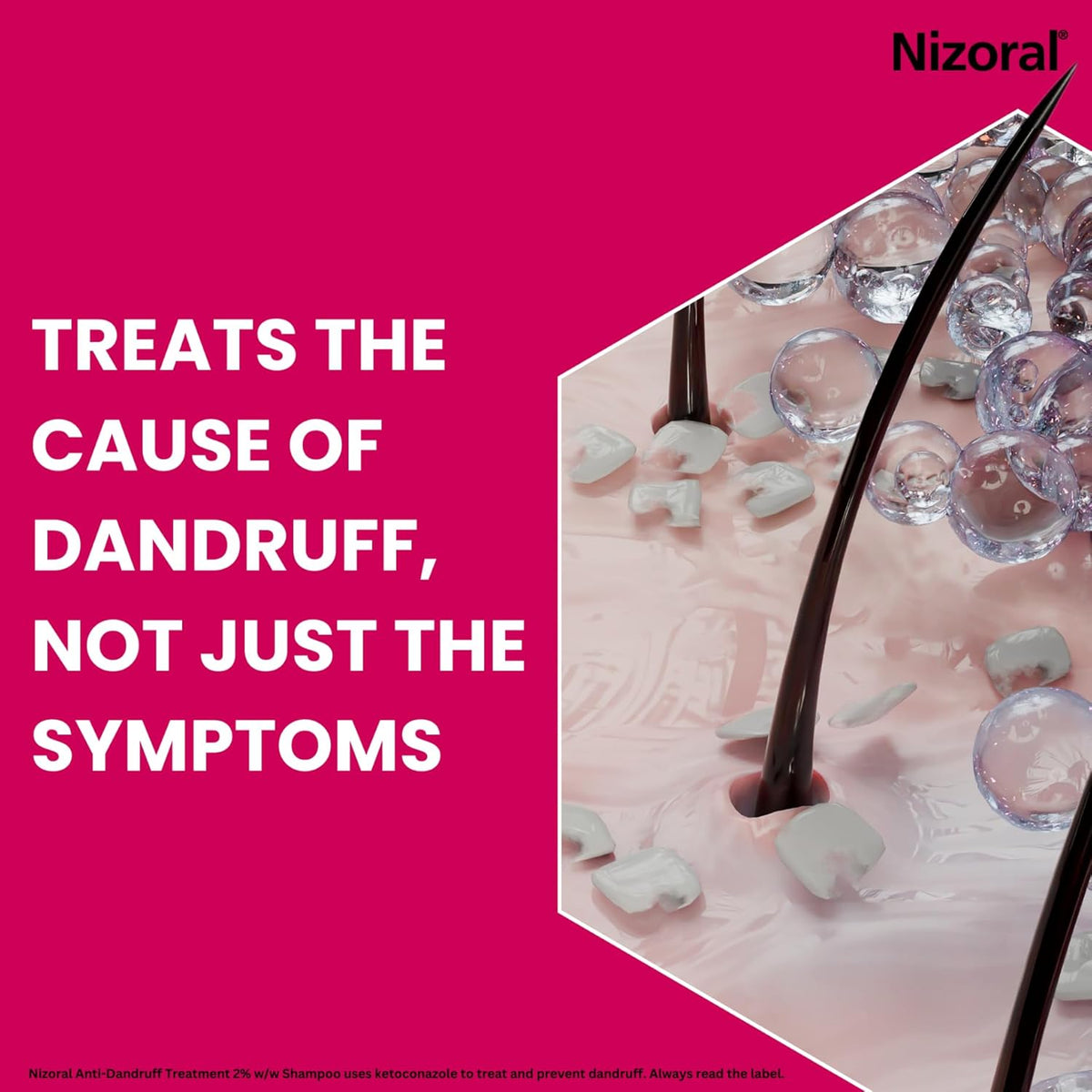 Nizoral Anti-Dandruff Treatment Shampoo, 1x100ml Bottle