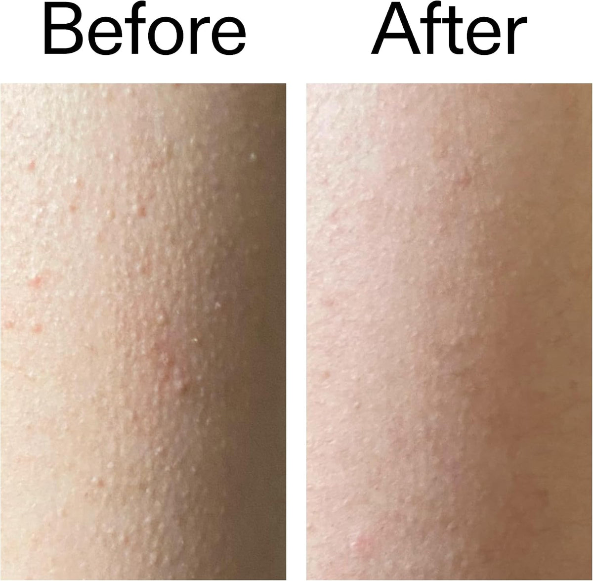The INKEY List Glycolic Acid Exfoliating Body Stick 45g