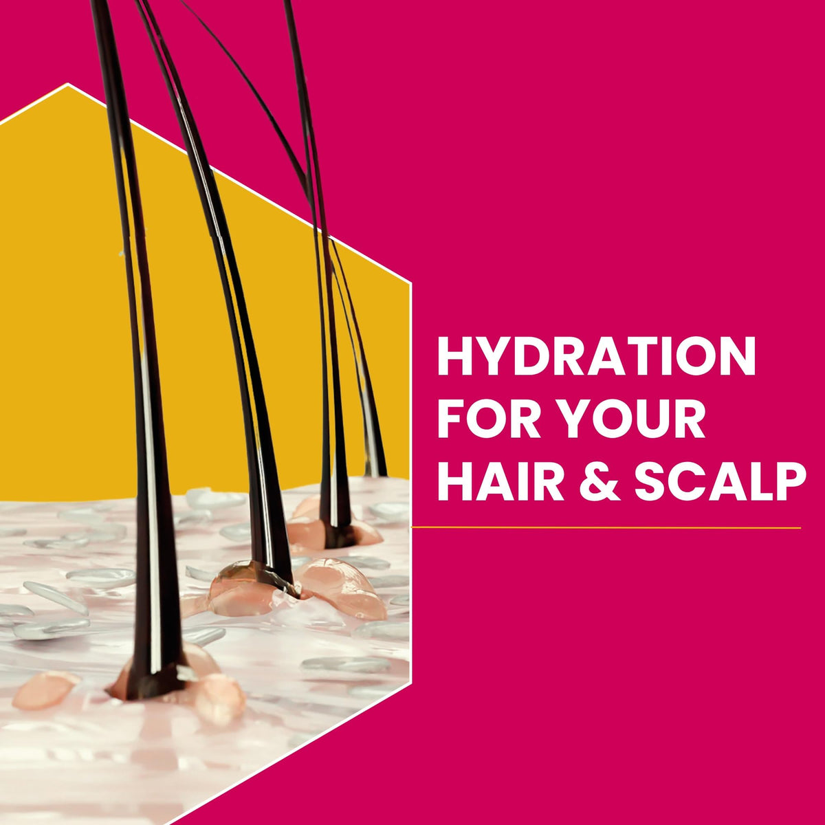 Nizoral Scalp Soothing Leave-In Treatment for Dry Itchy Scalp, 100ml