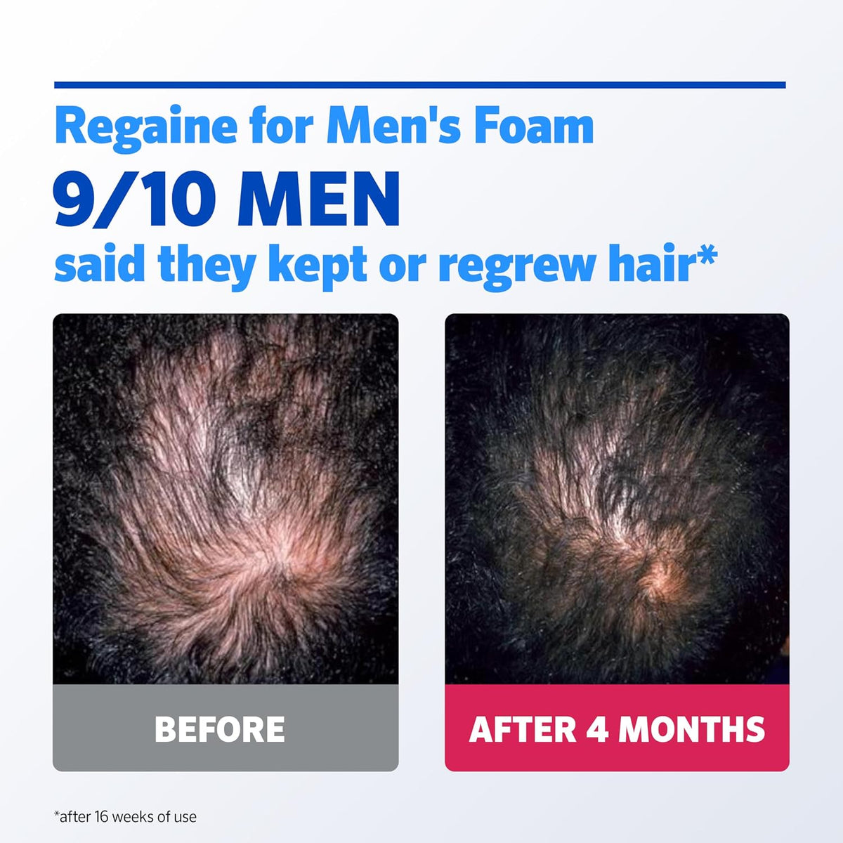 Regaine For Men Hair Regrowth Foam 3 x 73ml