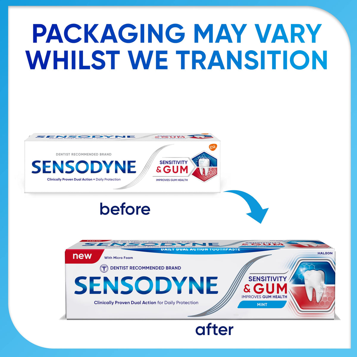 Sensodyne Toothpaste Sensitivity & Gum, Sensitive Toothpaste for Sensitive Teeth and Gum Problems, Mint Flavour, 75ml