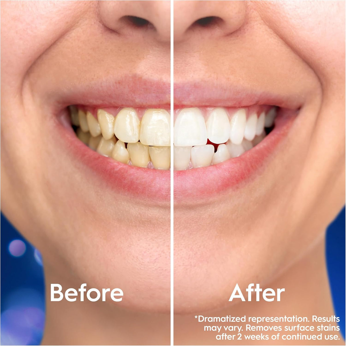 Oral-B Pro-3D White Clinical Intensive Whitening Toothpaste, 75ml