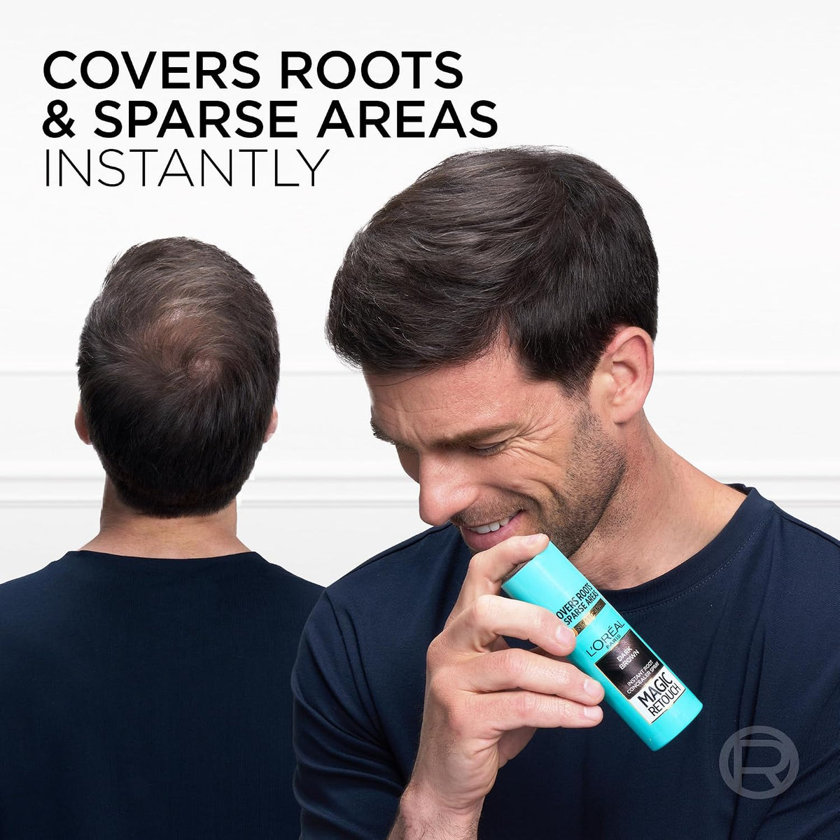 L'Oréal Paris Magic Retouch Temporary Root Touch Up Spray, Dark Brown 75ml