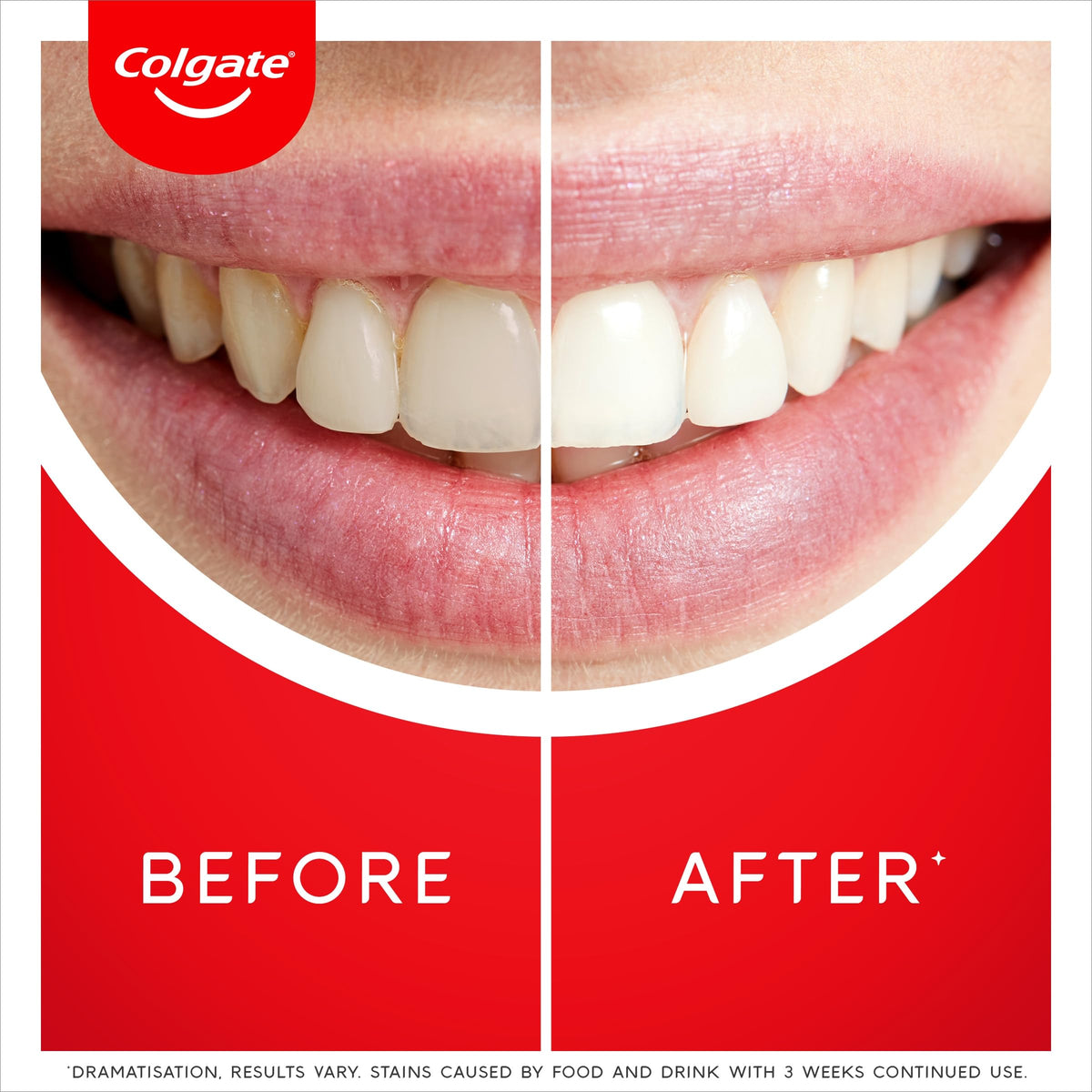Colgate Max White Ultra Active Foam Whitening Toothpaste, 75ml
