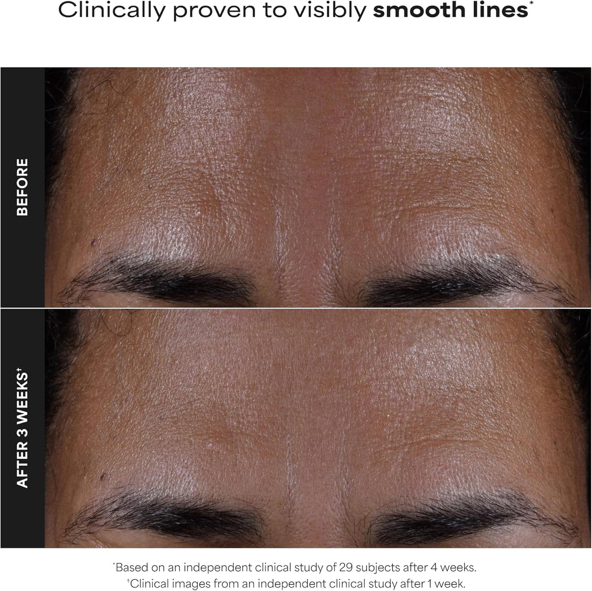 Paula's Choice Skin Perfecting 2% BHA Liquid Exfoliant