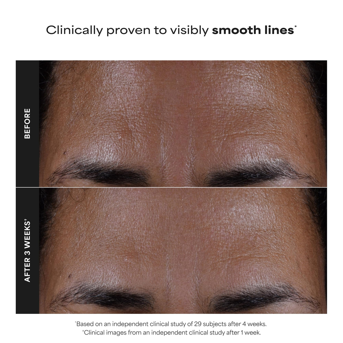 Paula's Choice Skin Perfecting 2% BHA Liquid Exfoliant