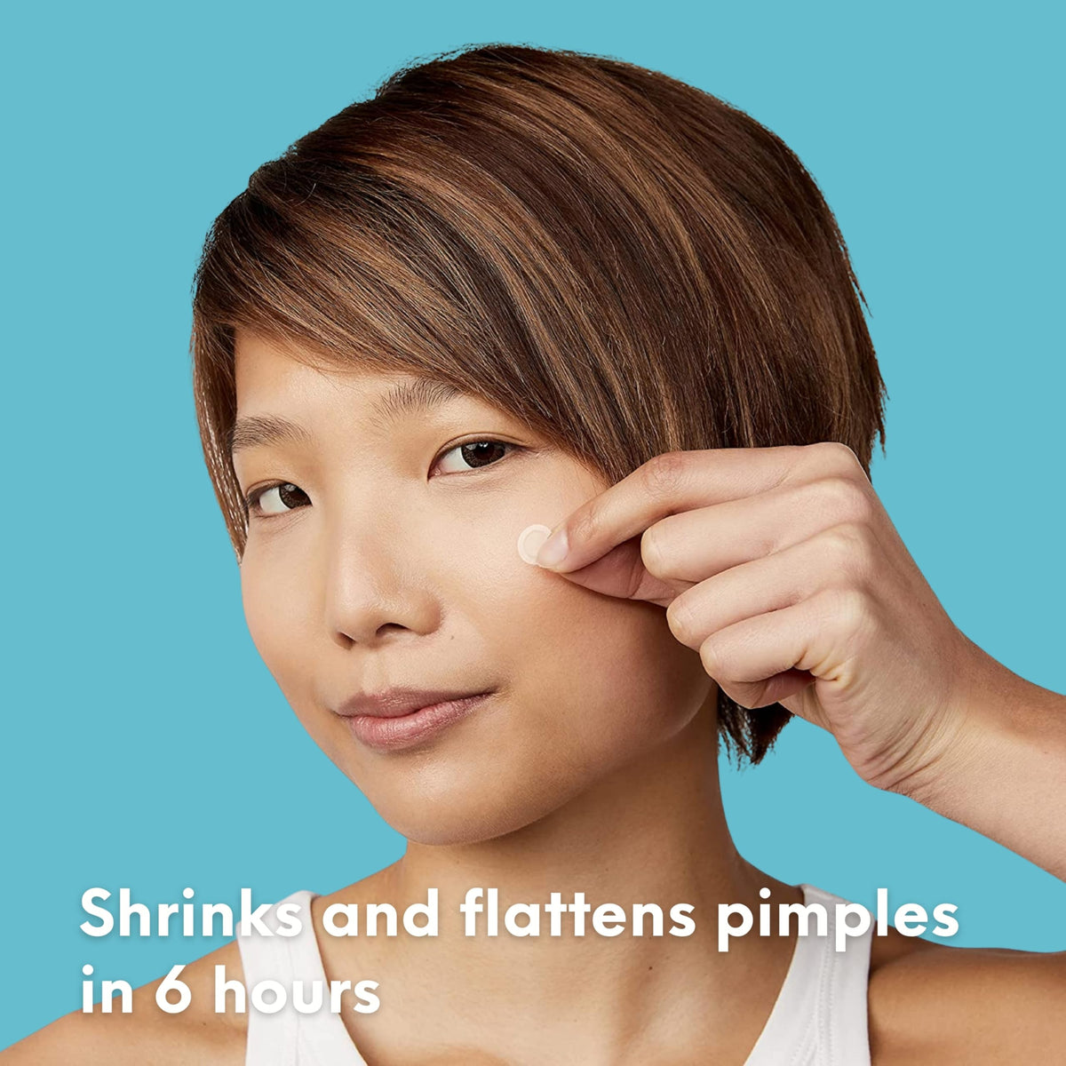 SKIN CHOICE Spot Patches, Invisible Hydrocolloid Pimple Patches, 30 PCs