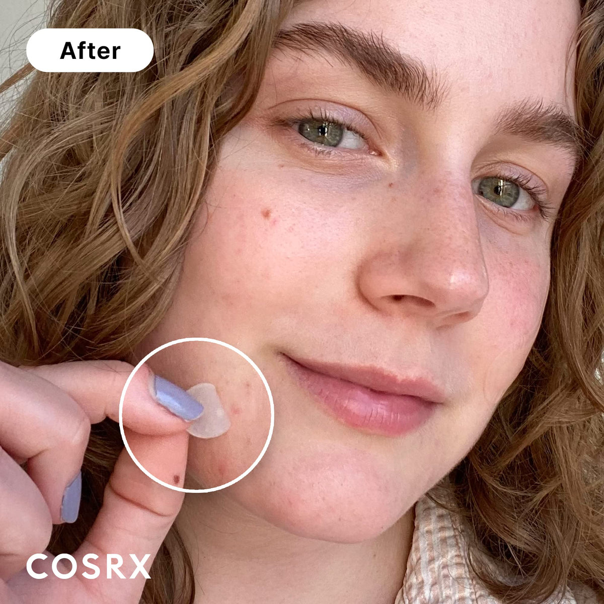 COSRX Master Patch Original Fit (24 counts) Absorbing Pimple Patches, Hydrocolloid Spot Treatment, Blemish Cover, Spot Stickers, 3 Sizes