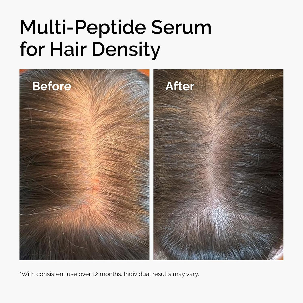 The Ordinary Multi-Peptide Serum for Hair Density and Scalp Support, Peptide-Powered Formula for Thicker, Fuller Looking Hair, 60ml