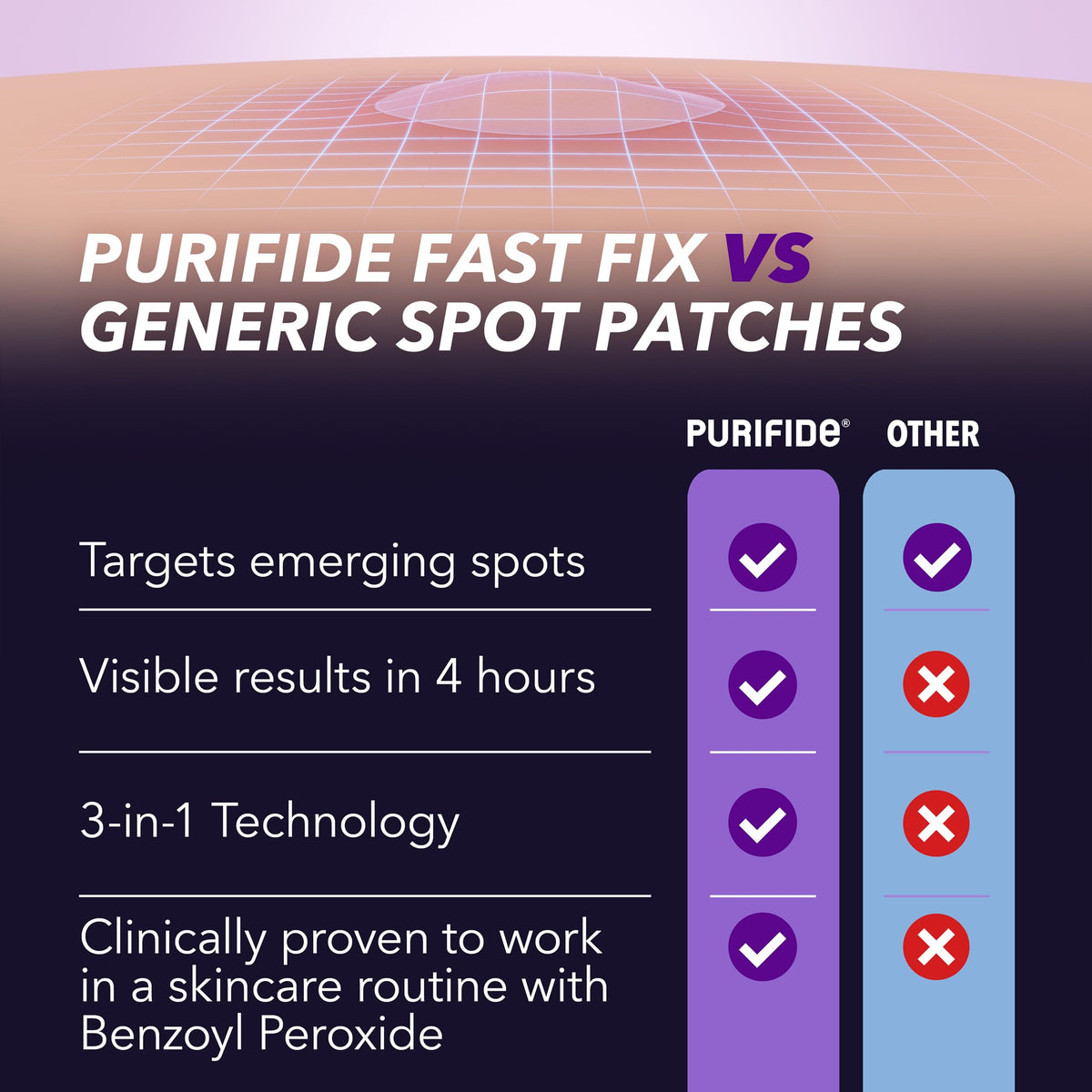 Acnecide Face Gel 5% Benzoyl Peroxide 15g