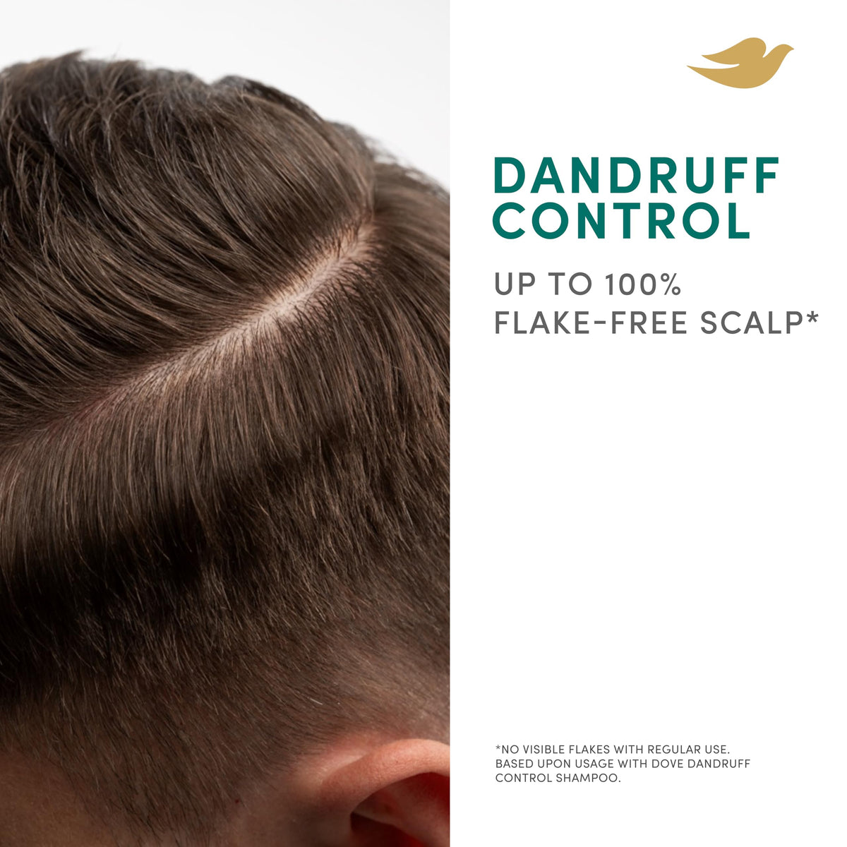 Dove Scalp + Hair Therapy Dandruff Control Shampoo hair care with Salicylic Acid, Piroctone and Panthenol for up to 100% flake-free scalp* 400 ml