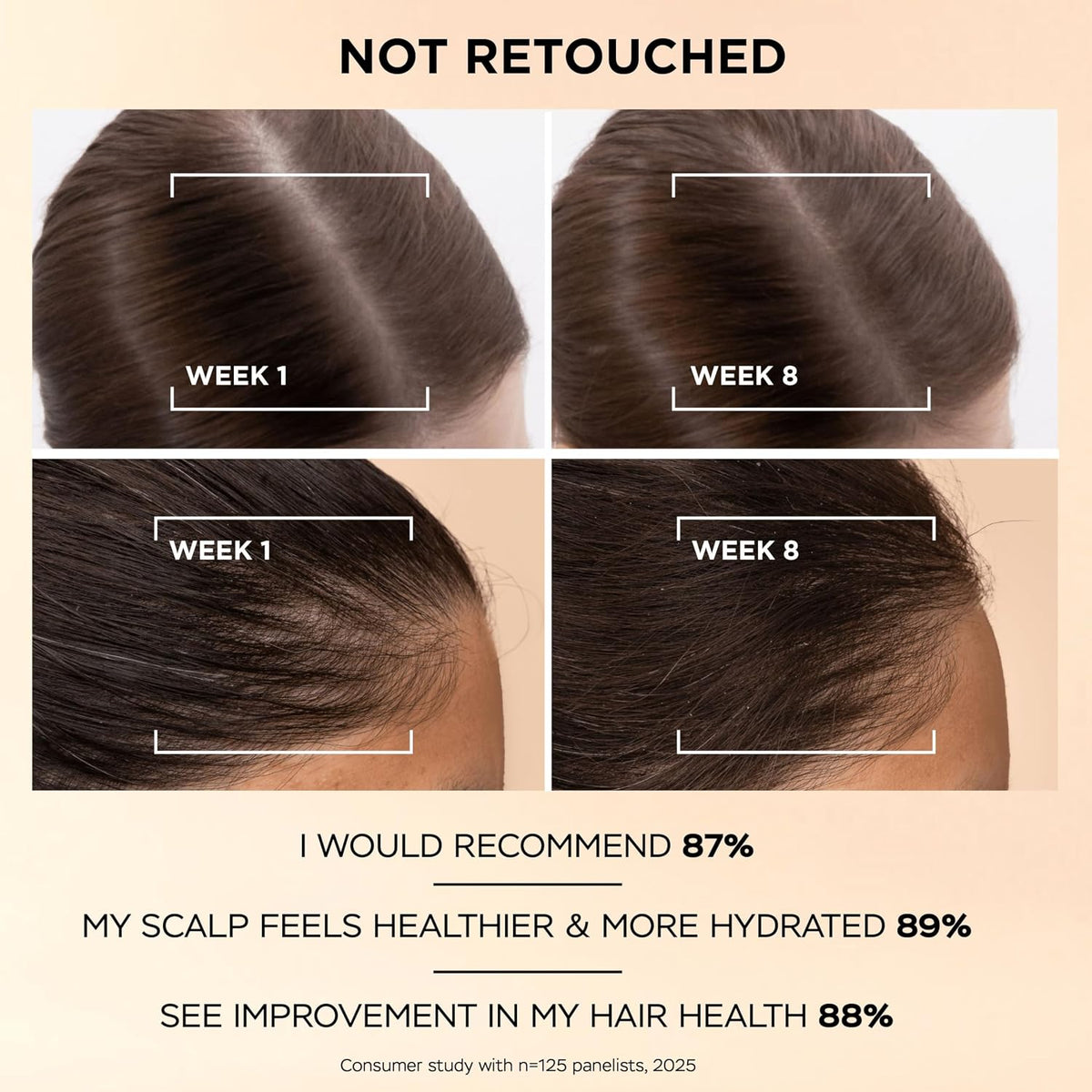 Pantene Grow Abundant Anti-Hair Loss Scalp Serum 60ml for Denser Hair