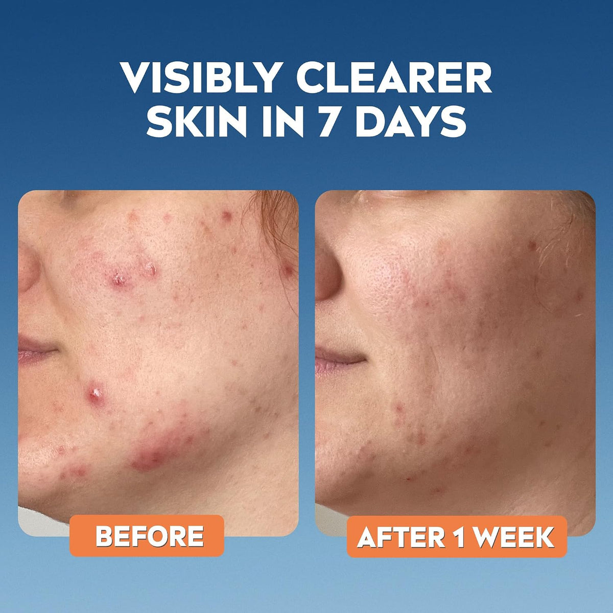 NIVEA Derma Skin Clear Wash Gel, 150ml