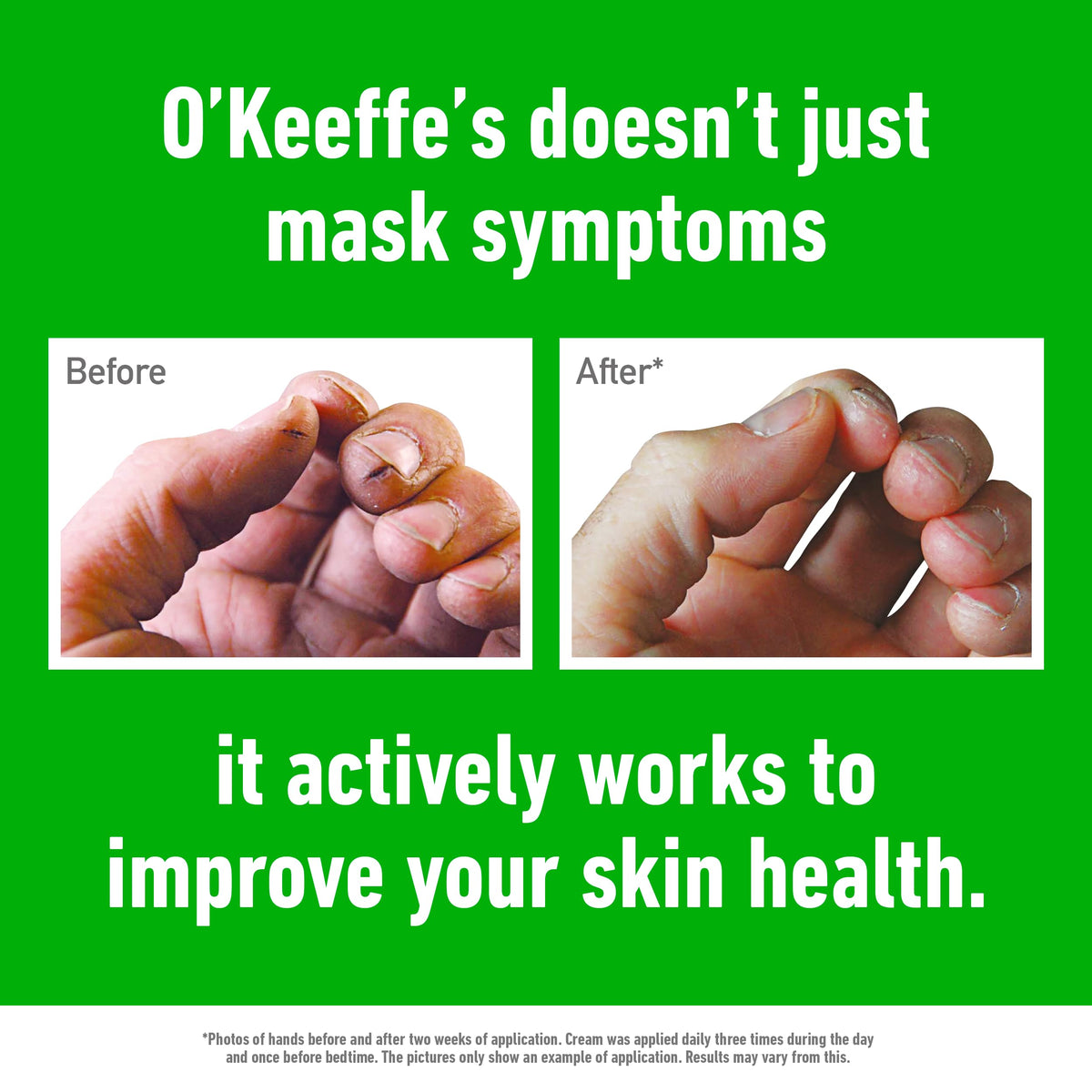 O'Keeffe's Working Hands, 96 g Jar 2 Pack - Hand Cream for Extremely Dry, Cracked Hands | Instantly Increases Moisture Content, Forms a Protective Layer and Prevents Moisture Loss