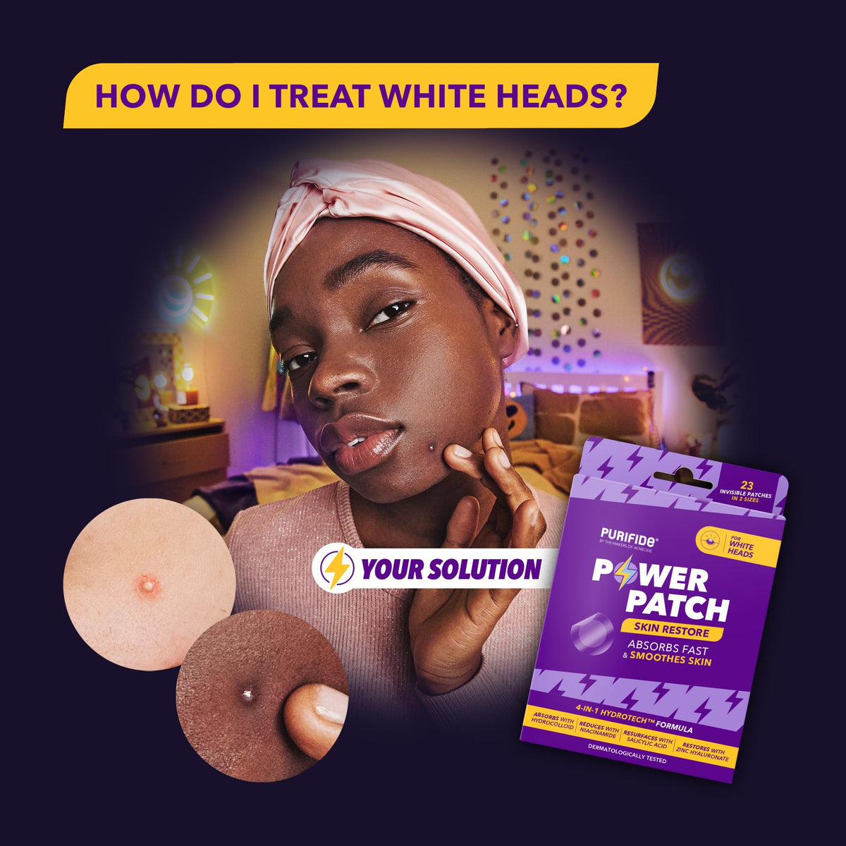 Acnecide Face Gel 5% Benzoyl Peroxide 15g