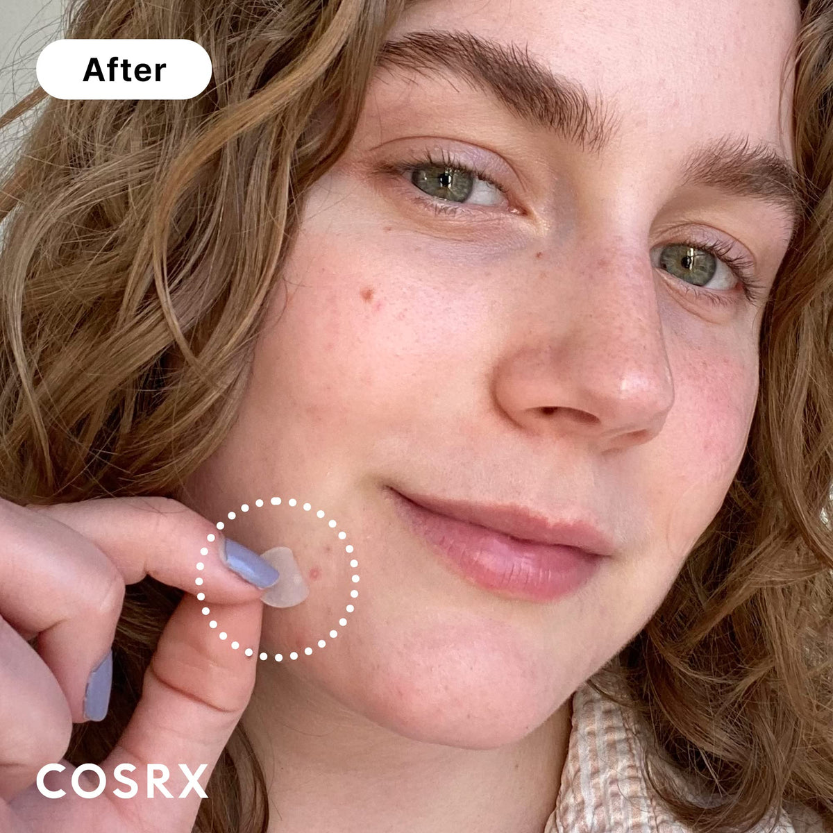 COSRX Master Patch Original Fit (24 counts) Absorbing Pimple Patches, Hydrocolloid Spot Treatment, Blemish Cover, Spot Stickers, 3 Sizes